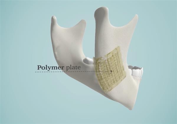 解決醫生煩惱 3D打印生物陶瓷修復骨骼


生物陶瓷,3D打印生物陶瓷,工業3d打印機,3D打印機價格,3D打印服務,3D打印技術,中國3d打印技術,上海3D打印,北京3D打印