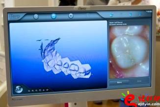 3d打印牙齒價格,3d打印牙齒模型,3d打印牙齒臨床了嗎,3d打印牙齒價格表,3d打印牙齒能用多久 3d打印牙齒價格,3d打印牙齒模型,3d打印牙齒臨床了嗎,3d打印牙齒價格表,3d打印牙齒能用多久