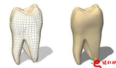 3d打印牙齒價格,3d打印牙齒模型,3d打印牙齒臨床了嗎,3d打印牙齒價格表,3d打印牙齒能用多久 3d打印牙齒價格,3d打印牙齒模型,3d打印牙齒臨床了嗎,3d打印牙齒價格表,3d打印牙齒能用多久